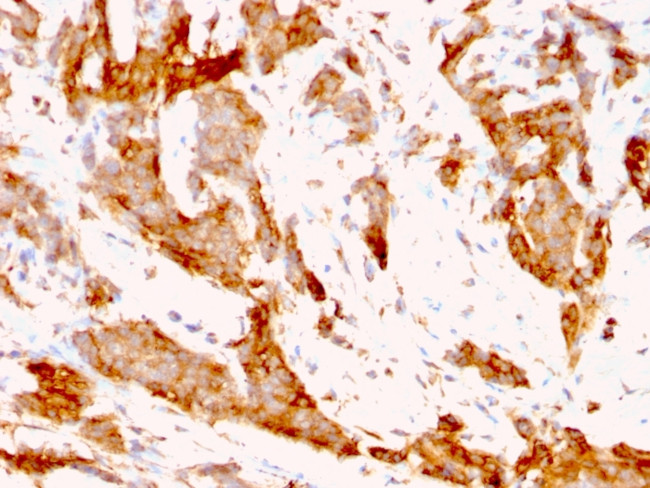 GRP94/HSP90B1 (Endoplasmic Reticulum Marker) Antibody in Immunohistochemistry (Paraffin) (IHC (P))