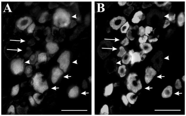 NMDAR2B Antibody in Immunocytochemistry (ICC/IF)