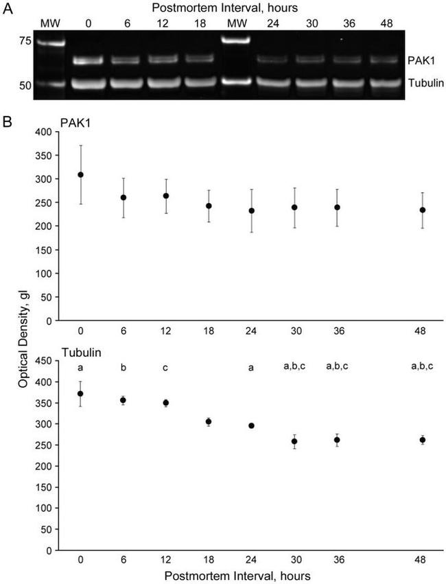 PAK1 Antibody in Western Blot (WB)