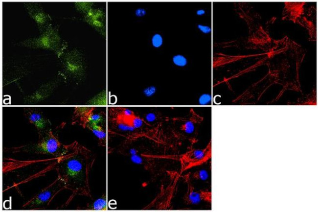 PAK1 Antibody in Immunocytochemistry (ICC/IF)