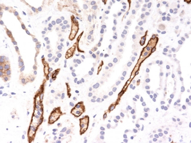 Complement 4d (C4d) Antibody in Immunohistochemistry (Paraffin) (IHC (P))