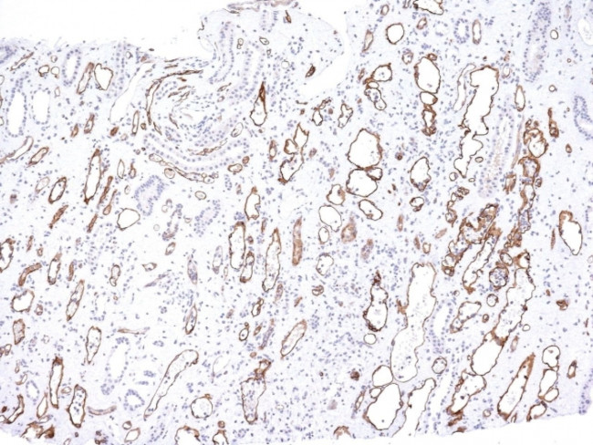 Complement 4d (C4d) Antibody in Immunohistochemistry (Paraffin) (IHC (P))