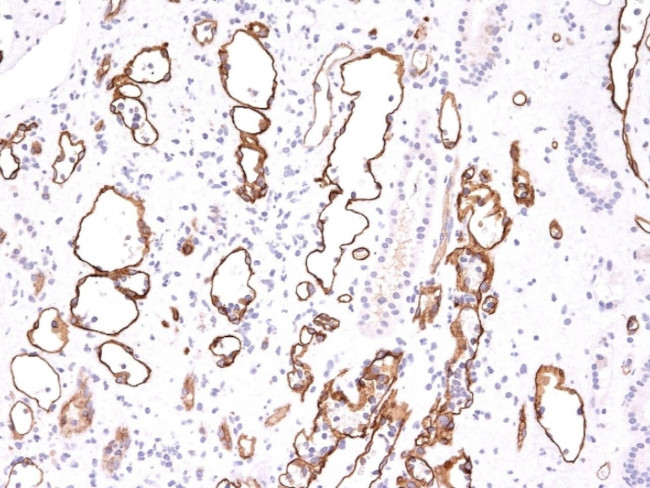 Complement 4d (C4d) Antibody in Immunohistochemistry (Paraffin) (IHC (P))