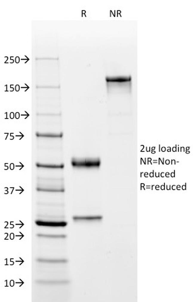 Complement 4d (C4d) Antibody in SDS-PAGE (SDS-PAGE)