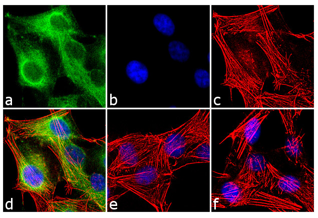 Huntingtin Antibody in Immunocytochemistry (ICC/IF)