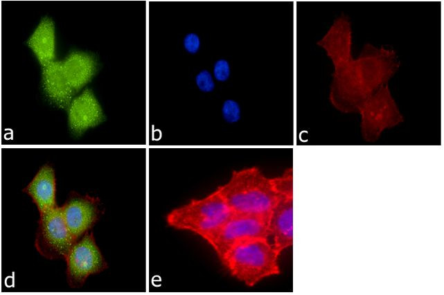 SALL4 Antibody in Immunocytochemistry (ICC/IF)