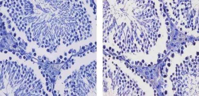 SALL4 Antibody in Immunohistochemistry (Paraffin) (IHC (P))