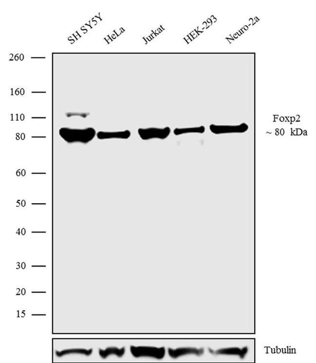 FOXP2 Antibody in Western Blot (WB)