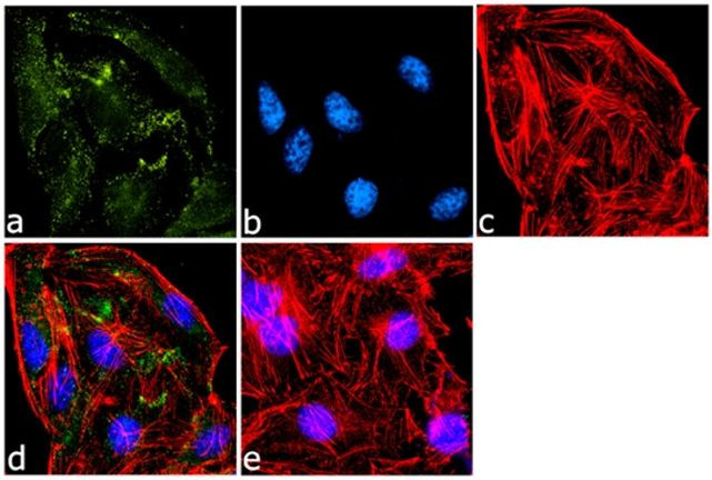 ATG3 Antibody in Immunocytochemistry (ICC/IF)