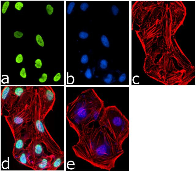 H2AK5ac Antibody in Immunocytochemistry (ICC/IF)