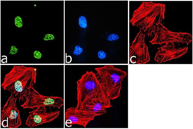 H4K16ac Antibody in Immunocytochemistry (ICC/IF)