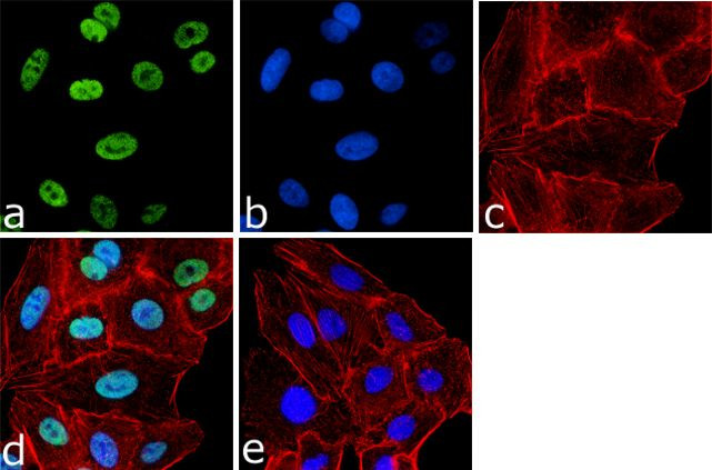 H4K20ac Antibody in Immunocytochemistry (ICC/IF)