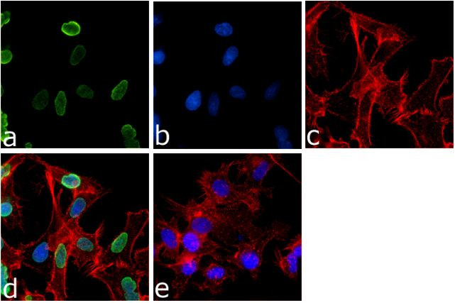 H3K9me2 Antibody in Immunocytochemistry (ICC/IF)