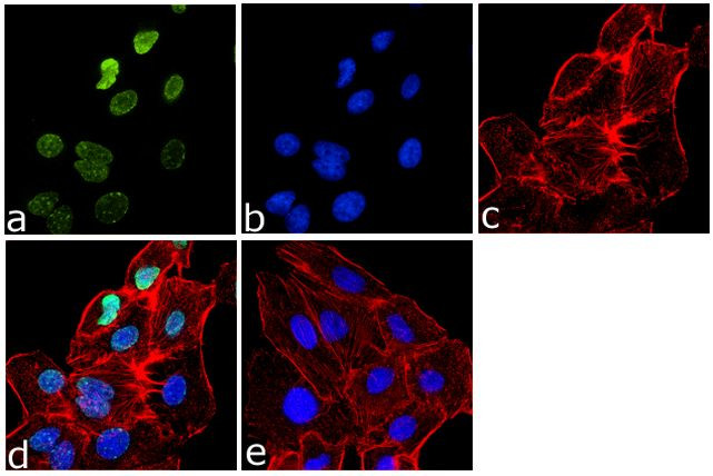 H3K9me3 Antibody in Immunocytochemistry (ICC/IF)