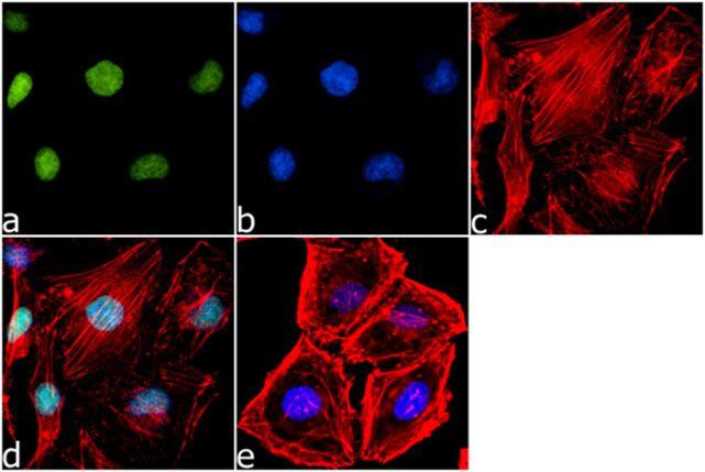 H3K14ac Antibody in Immunocytochemistry (ICC/IF)