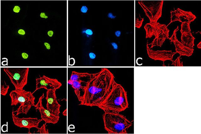 H3K18ac Antibody in Immunocytochemistry (ICC/IF)