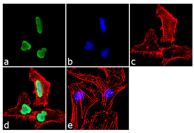 H3K27me2 Antibody in Immunocytochemistry (ICC/IF)