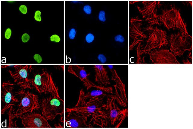 H4K12ac Antibody in Immunocytochemistry (ICC/IF)