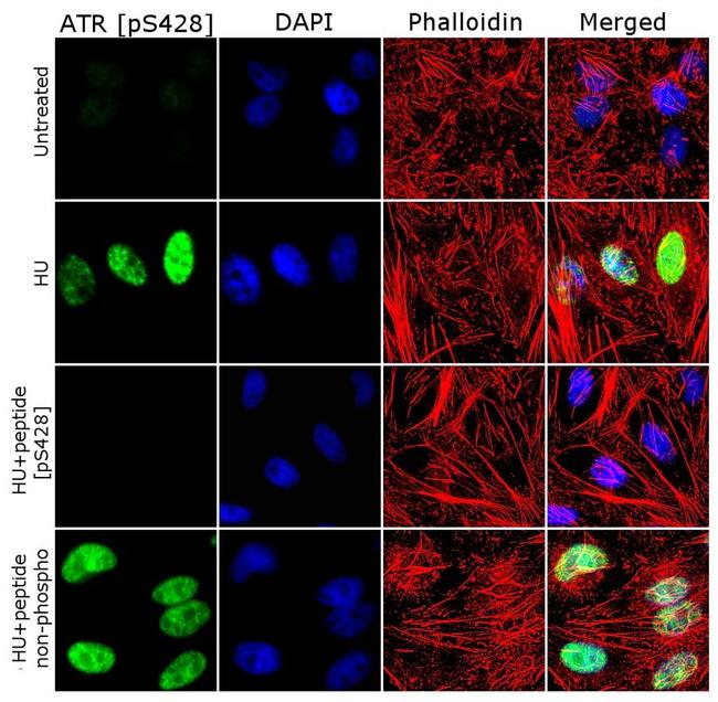 Phospho-ATR (Ser428) Antibody