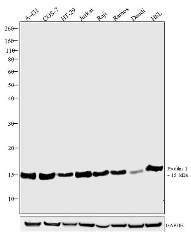 Profilin 1 Antibody in Western Blot (WB)