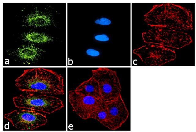 TYK2 Antibody in Immunocytochemistry (ICC/IF)