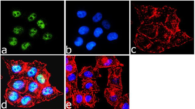 BRG1 Antibody in Immunocytochemistry (ICC/IF)