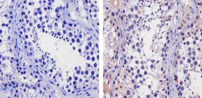 TIP60 Antibody in Immunohistochemistry (Paraffin) (IHC (P))