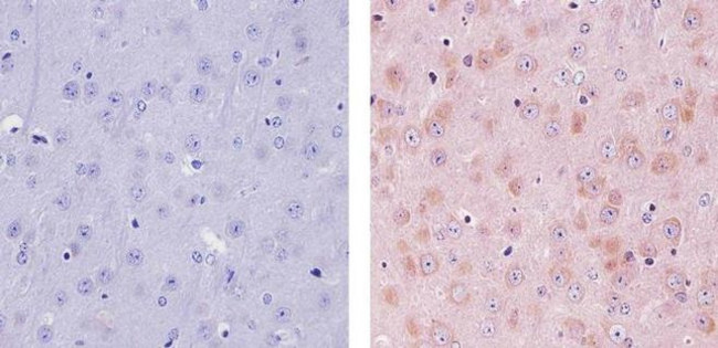 TIP60 Antibody in Immunohistochemistry (Paraffin) (IHC (P))