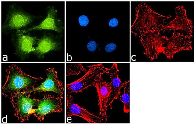 PRMT7 Antibody in Immunocytochemistry (ICC/IF)