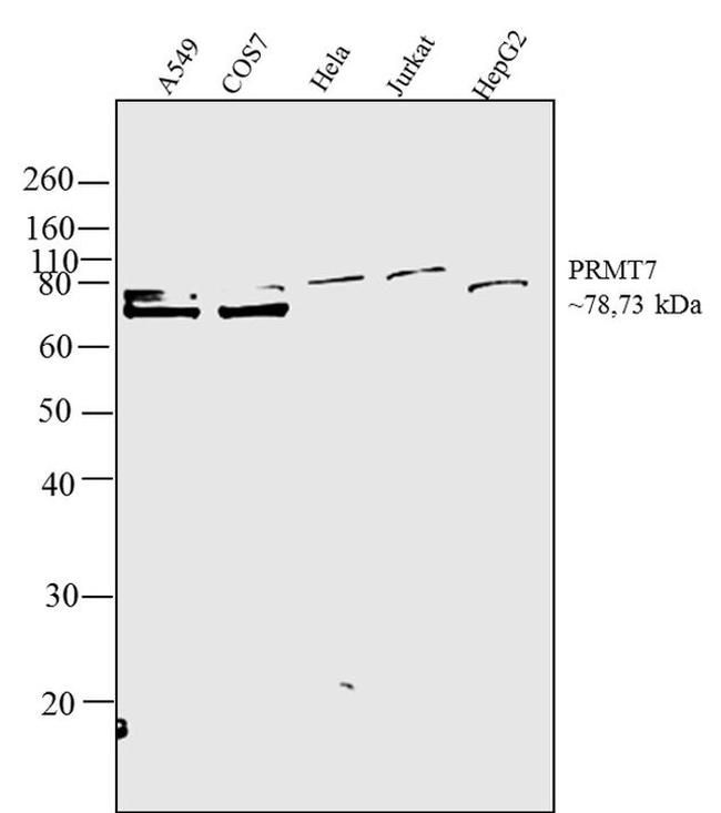 PRMT7 Antibody in Western Blot (WB)