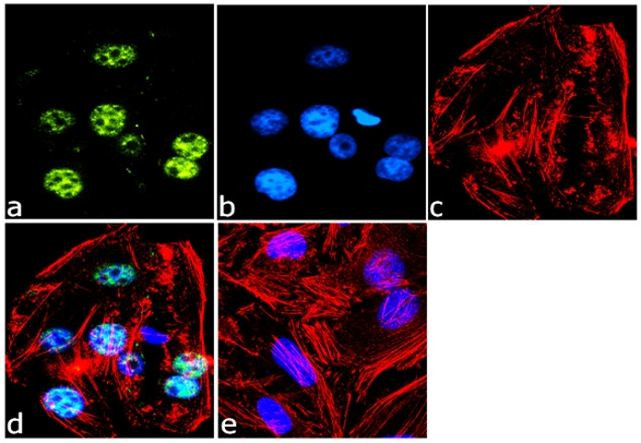 RNF20 Antibody in Immunocytochemistry (ICC/IF)