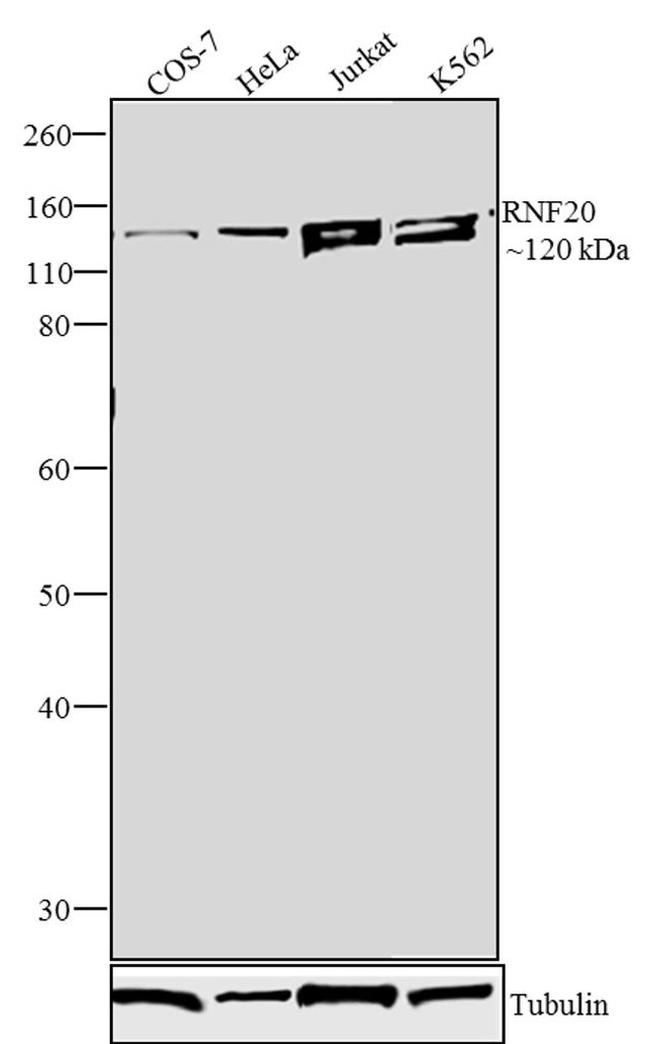 RNF20 Antibody in Western Blot (WB)