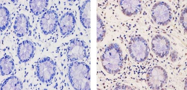 RNF20 Antibody in Immunohistochemistry (Paraffin) (IHC (P))