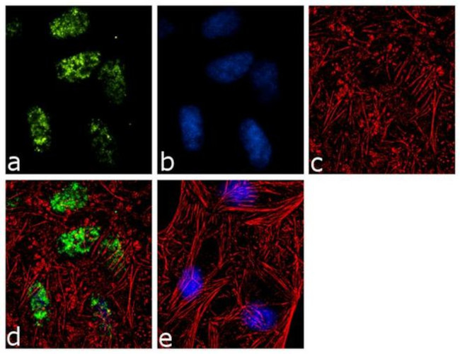 H2AK119ub Antibody in Immunocytochemistry (ICC/IF)