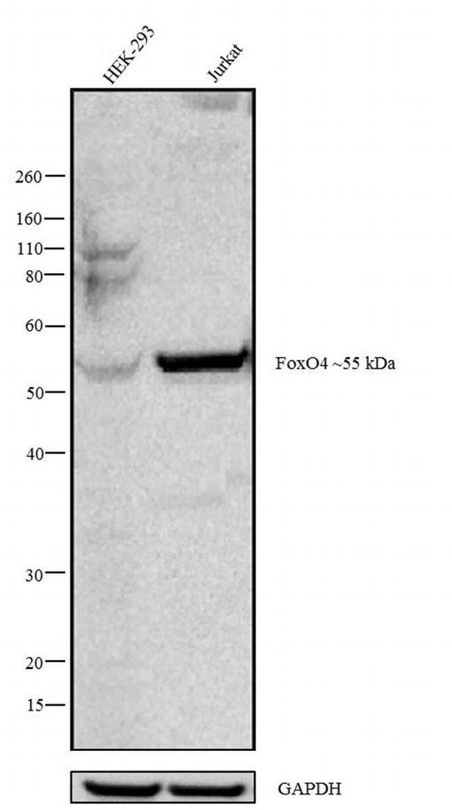 FOXO4 Antibody in Western Blot (WB)