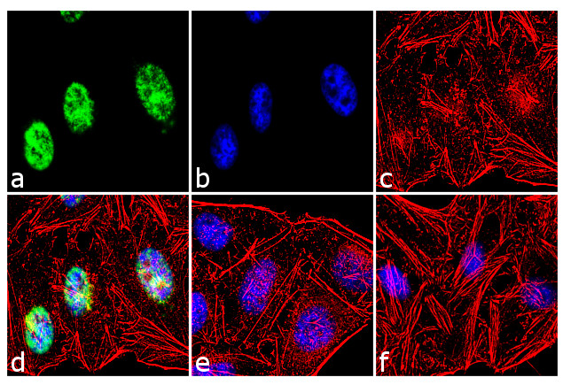 MSX1 Antibody in Immunocytochemistry (ICC/IF)