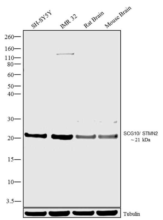 STMN2 Antibody in Western Blot (WB)