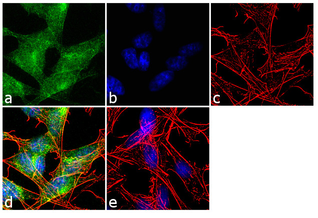 OMG Antibody in Immunocytochemistry (ICC/IF)