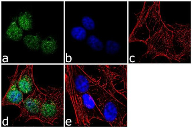 EOMES Antibody in Immunocytochemistry (ICC/IF)