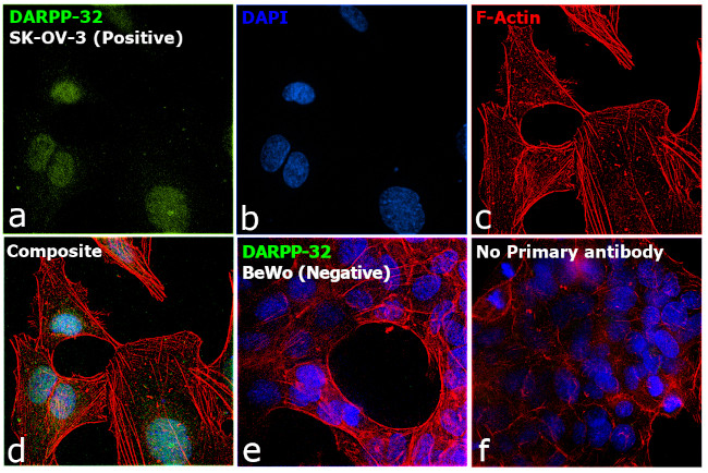 DARPP-32 Antibody