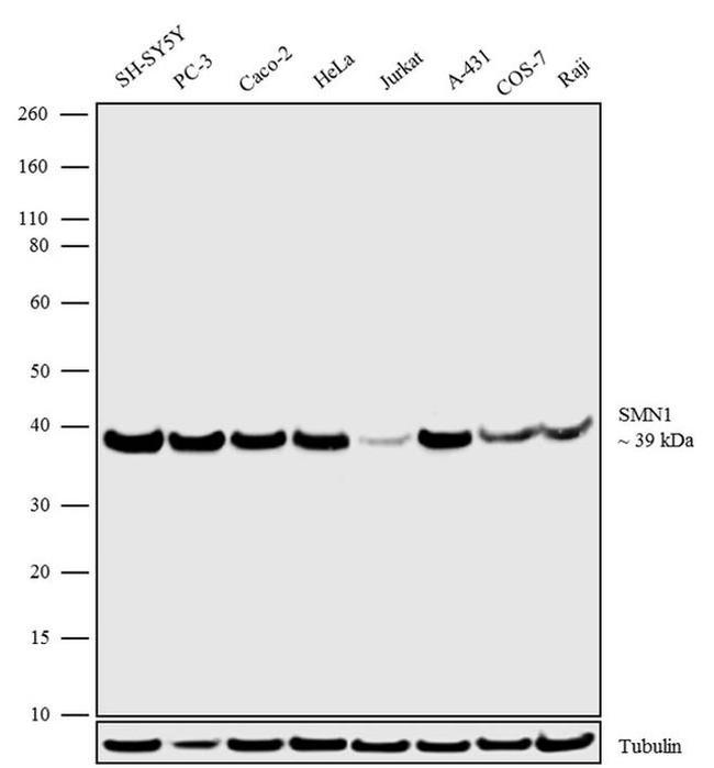 SMN1 Antibody in Western Blot (WB)