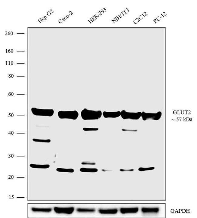 GLUT2 Antibody in Western Blot (WB)