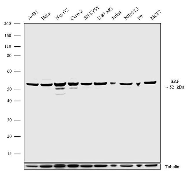 SRF Antibody in Western Blot (WB)