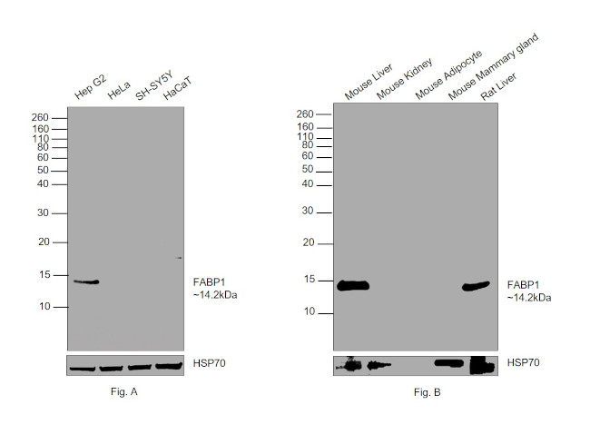 FABP1 Antibody