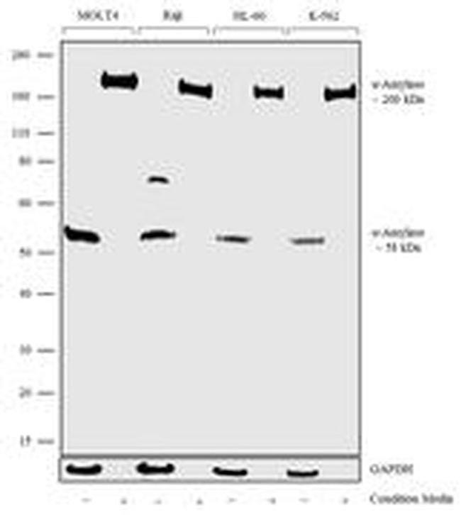 Pancreatic Amylase Antibody in Western Blot (WB)