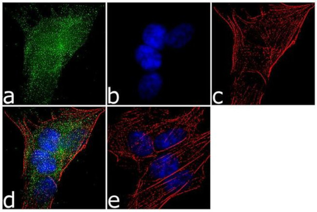 HTR2C Antibody in Immunocytochemistry (ICC/IF)