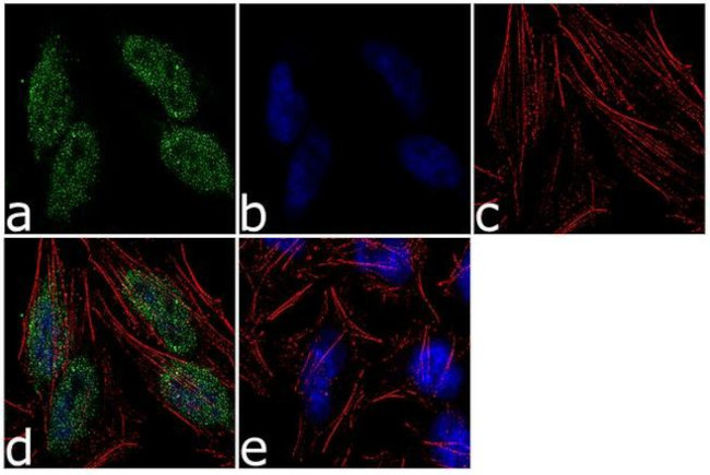 RAD17 Antibody in Immunocytochemistry (ICC/IF)