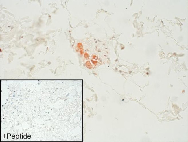 GABBR2 Antibody in Immunohistochemistry (IHC)