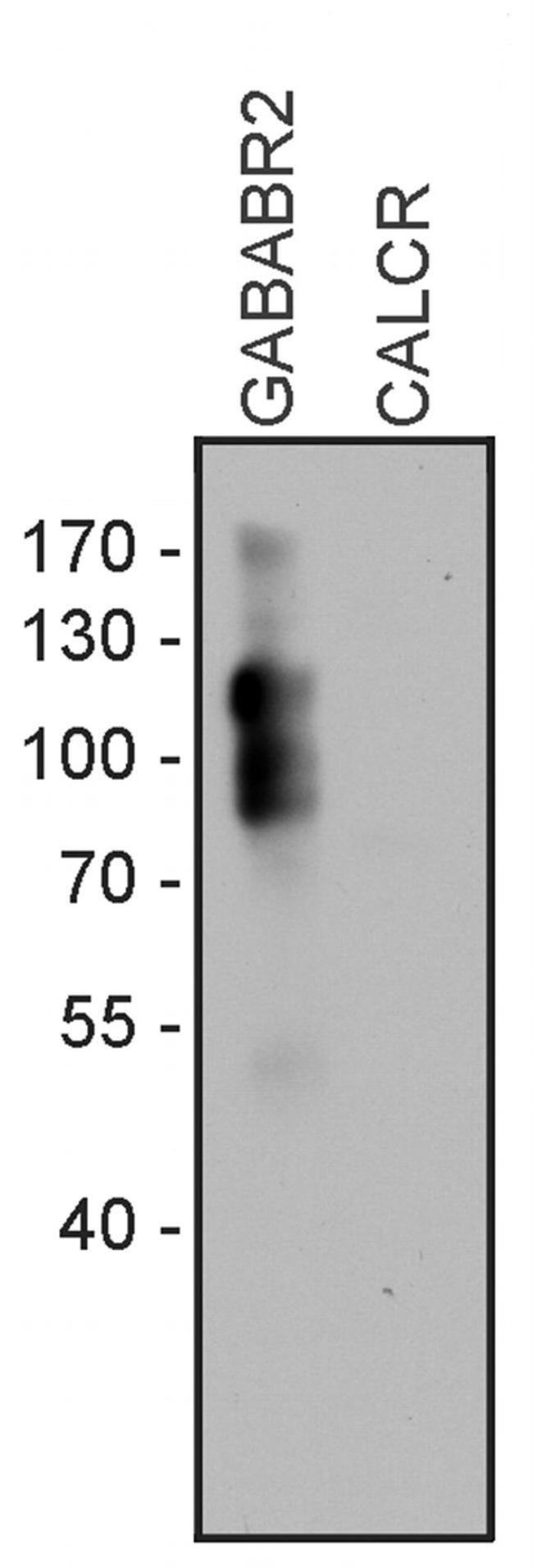 GABBR2 Antibody in Western Blot (WB)