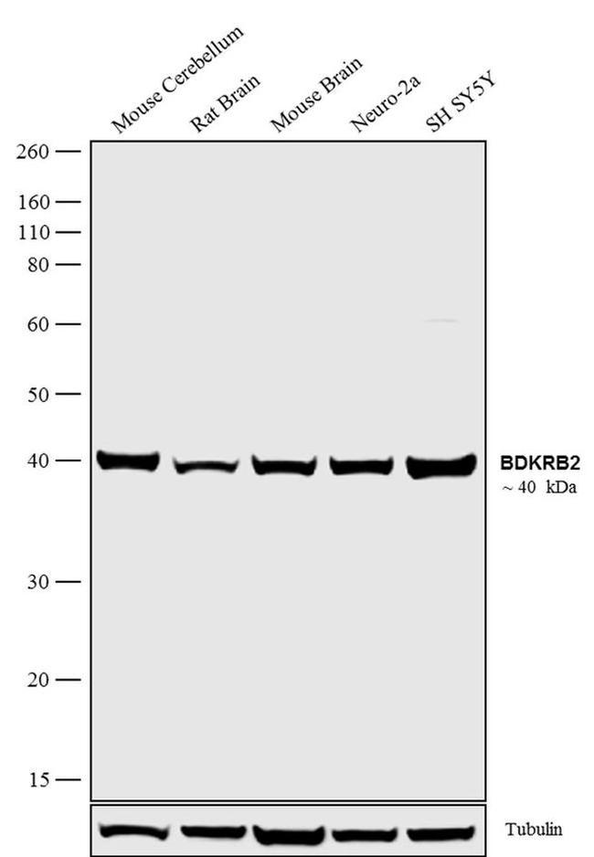 BDKRB2 Antibody in Western Blot (WB)